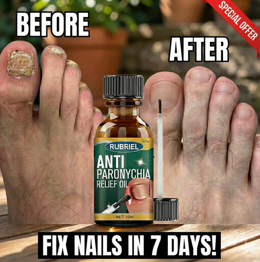Anti-Paronychia Relief Oil, Professional Nail Repair Serum - 10MLFungal Damaged Nails Repair (BUY 1 GET 1)